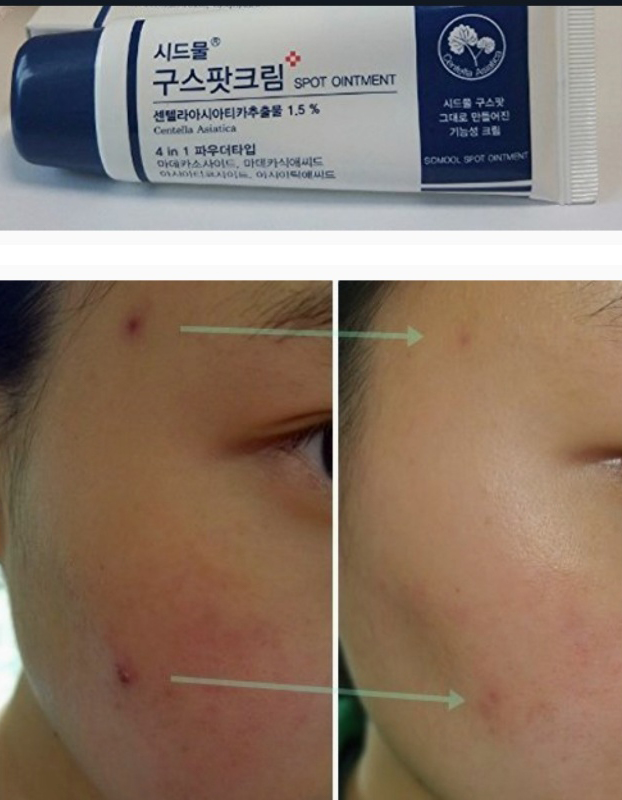 [Nhacuabeautyholic] Kem chấm mụn SIDMOOL CENTELLA GOOD SPOT CREAM