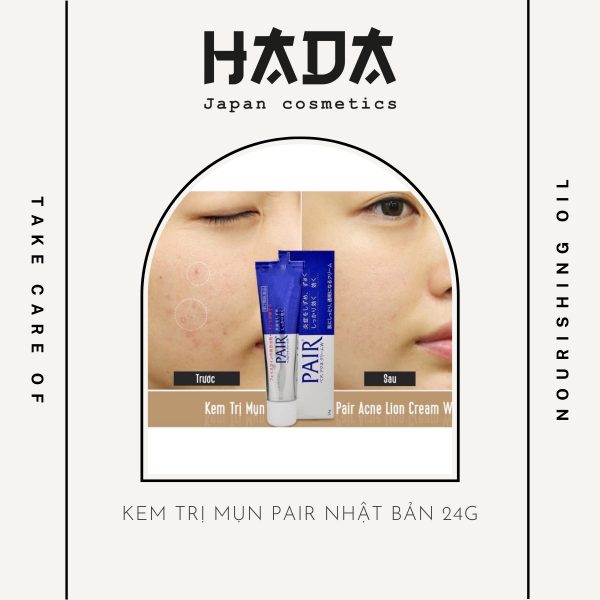 Kem trị mụn Pair Nhật Bản 24g - HADA COSMETIC