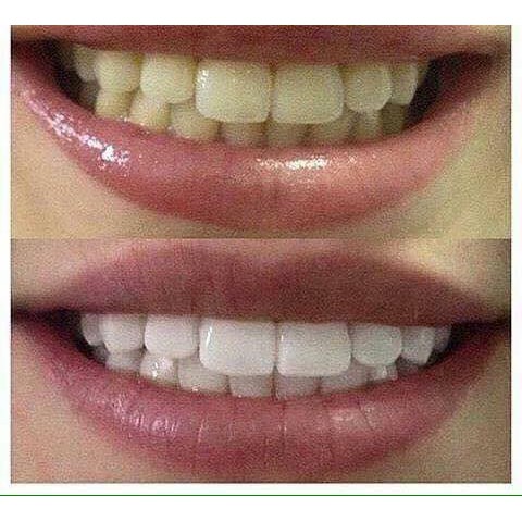 Kem Đánh Răng Crest Gum Detoxify Siêu Trắng 147gr