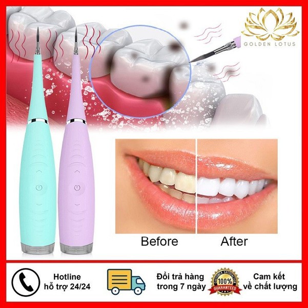 Dụng cụ Lấy Cao Răng - Máy Lấy Cao Răng Sạc Điện Cao Cấp