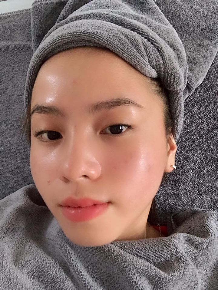 Tế bào gốc Ronas Stem Cell Hàn Quốc Dưỡng Ẩm Tái Tạo Da