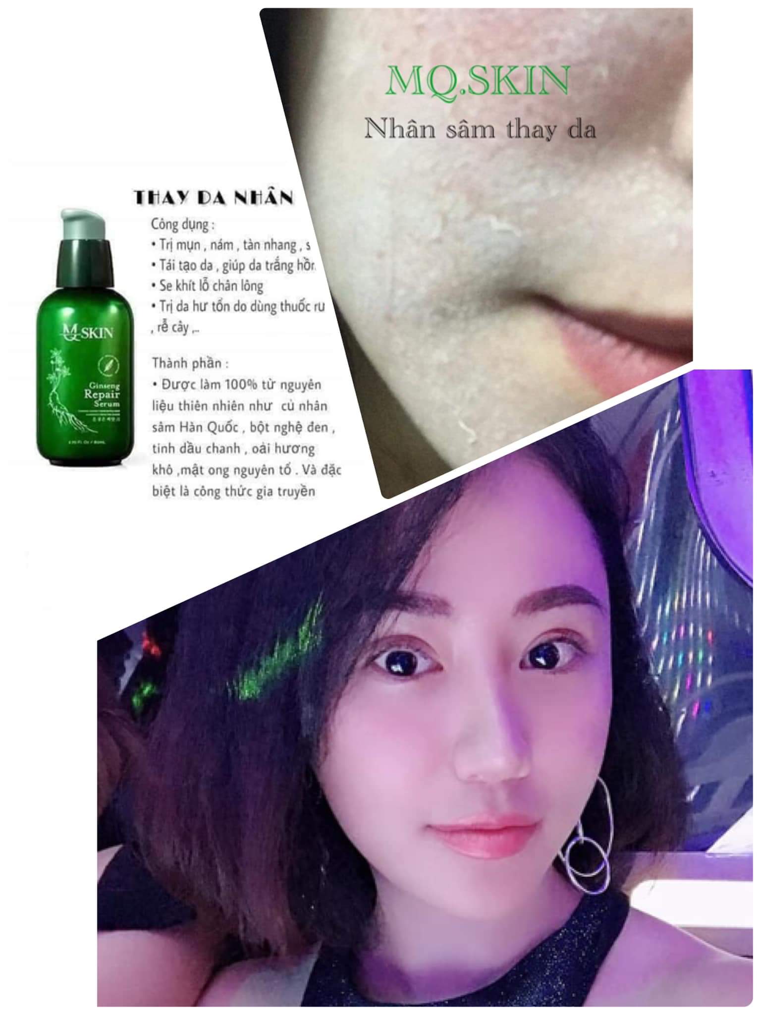 [HCM]SERUM THAY DA NHÂN SÂM MQ SKIN