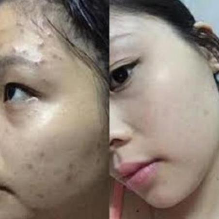 TÁI TẠO DA THUỐT BẮC ANGEL 50ML