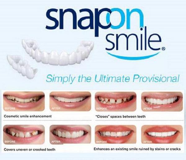 Euro Quality - Răng thẩm mỹ Snap on smile