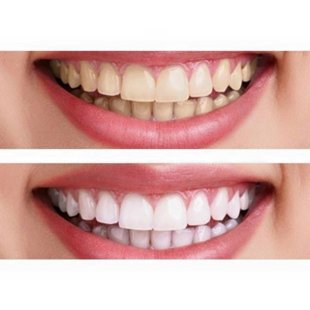 Bột Tẩy Trắng Răng Eucryl Toothpowder Freshmint 50g
