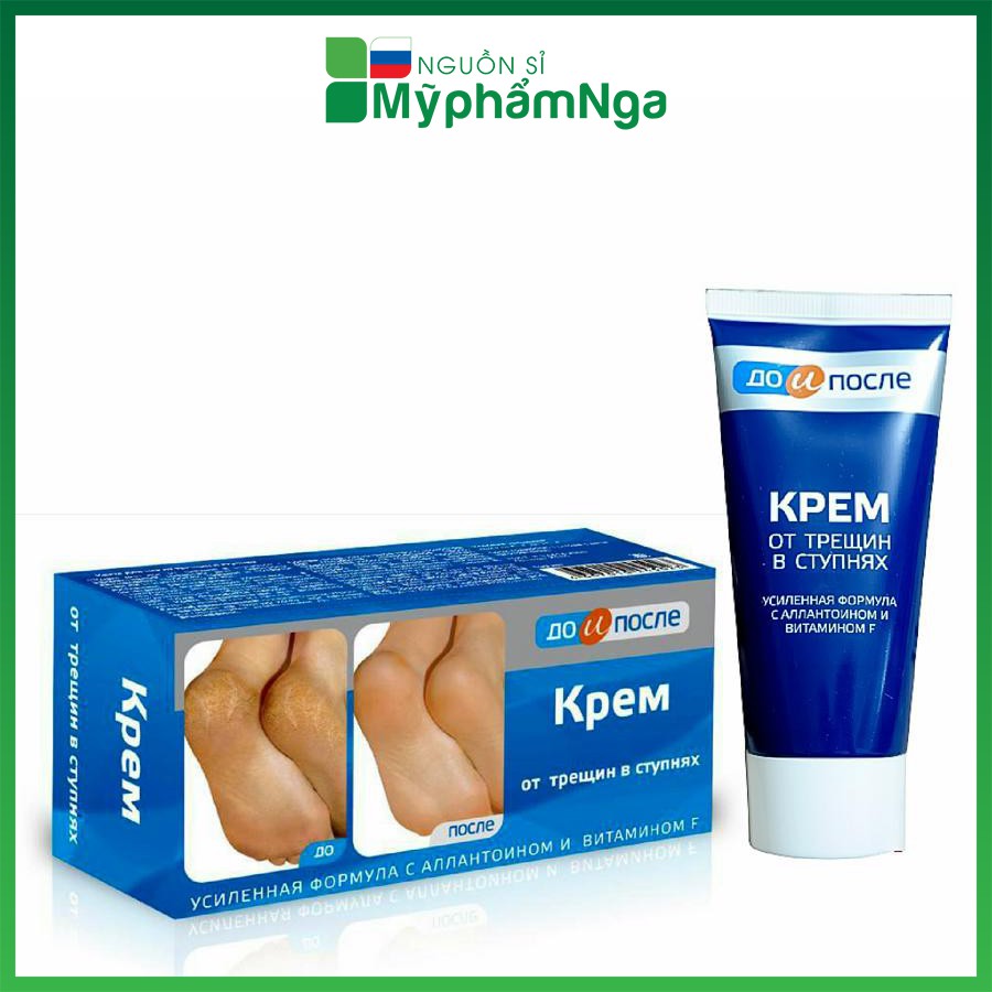 Nứt gót chân Nga Kpem dưỡng ẩm làm mềm gót chân