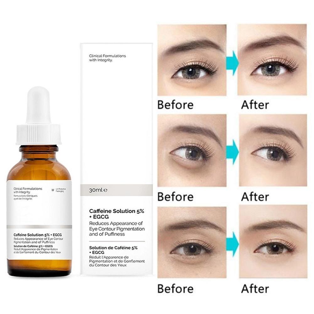 The Ordinary. Caffein Solution 5% + EGCG - Tinh chất dưỡng mắt chống quầng thâm