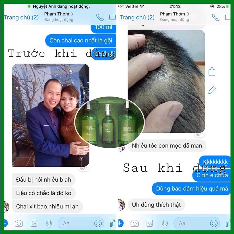 XỊT BƯỞI VIJULLY KÍCH MỌC TÓC NGĂN RỤNG TÓC