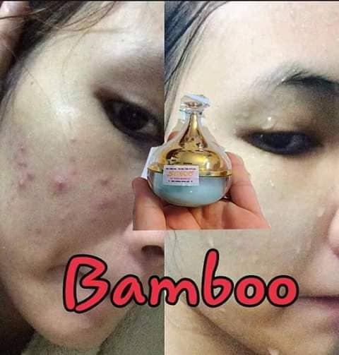 Mụn Bamboo