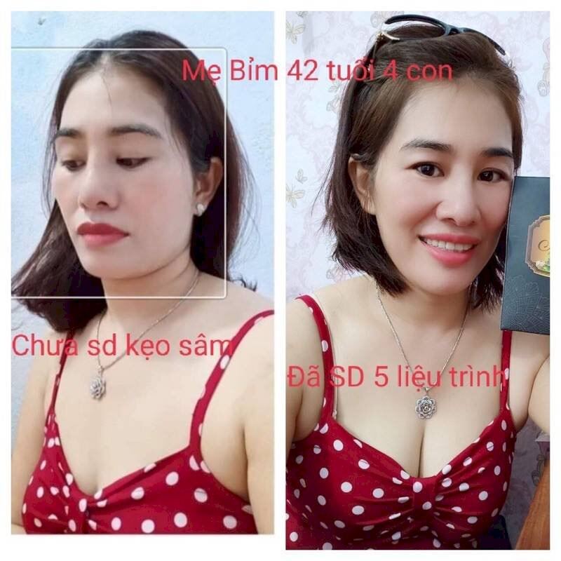 Kẹo mầm Sâm Tố Nữ Plus X2 nở ngực siêu tốc- Thảo Mộc 37