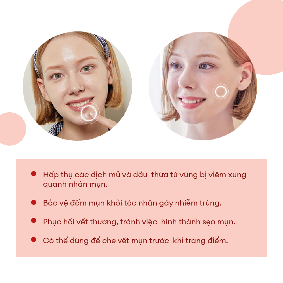 Dán Mụn COSRX Acne Pimple Master Patch 24 miếng/ gói