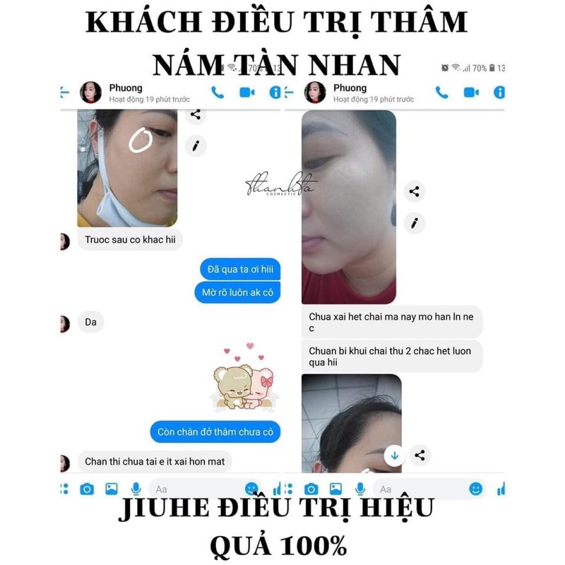 Sỉ jiuhe chính hãng mờ thâm nám sạm