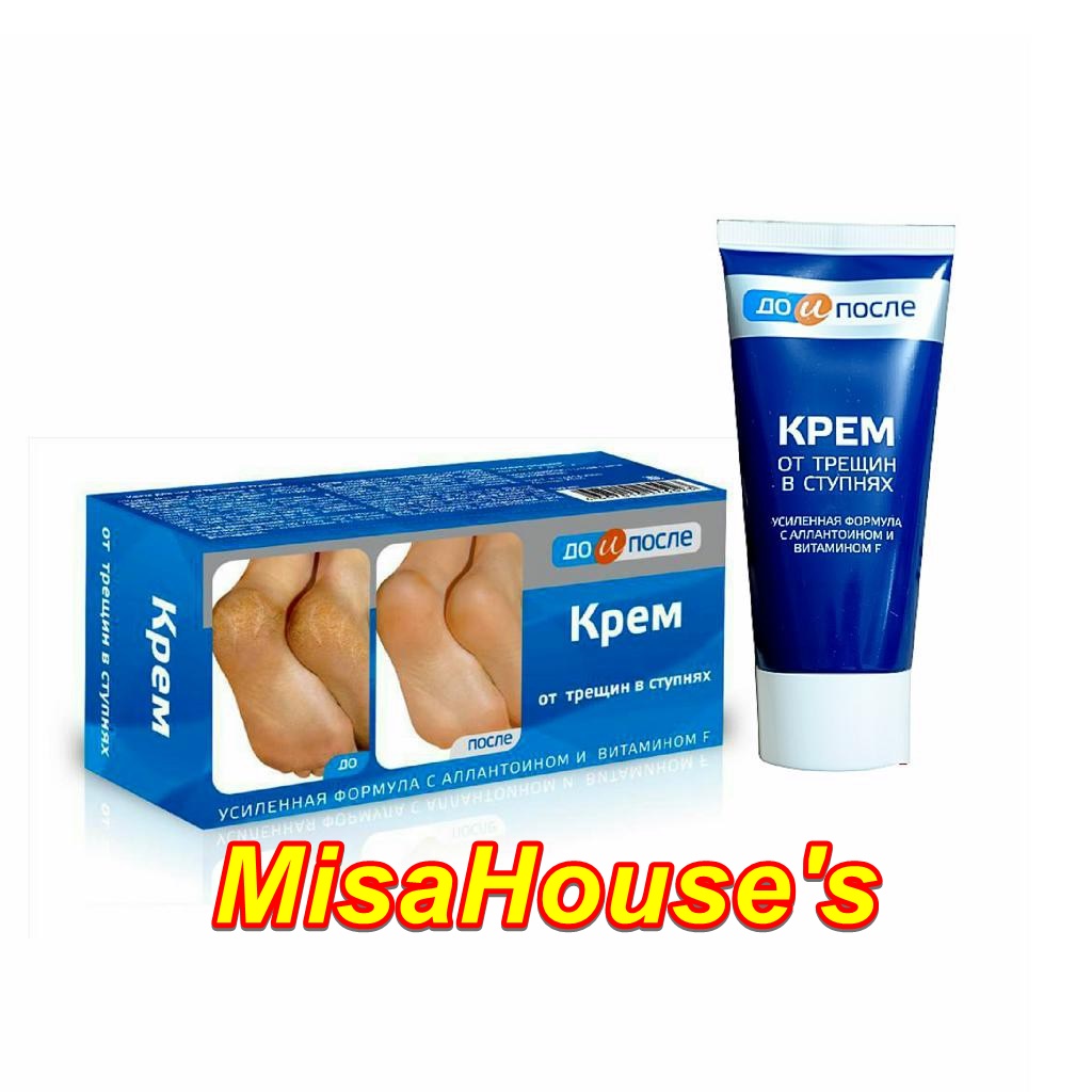 Kem Giảm Nứt Gót Chân KPEM Dưỡng Ẩm và Làm Mềm 50ml NGA