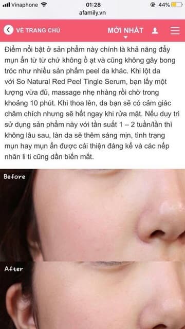 Thay Da Sinh Học RED PEEL TINGLE SERUM (Dạng gói)