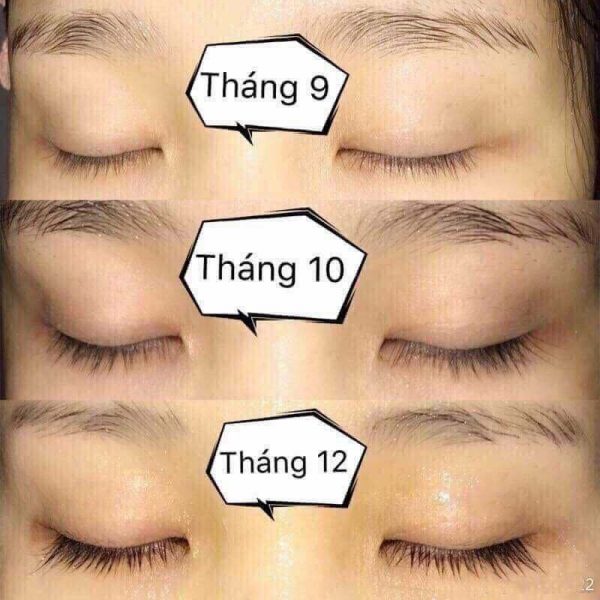Serum Dưỡng Dài Mi Gemsho Mẫu Mới