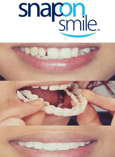 Răng Giả Snap On Smile - Mang Lại Sự Thoải Mái Tiện Lợi Và Phù Hợp Với Tính Thẩm Mỹ Cao