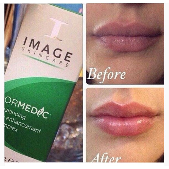 [HCM]Son dưỡng môi căng mọng ORMEDIC BALANCING LIP ENHANCEMENT COMPLEX IMAGE
