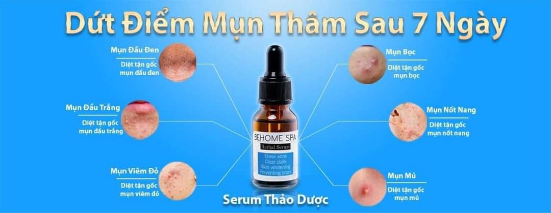 [HCM]SERUM THẢO DƯỢC BEHOMESPA