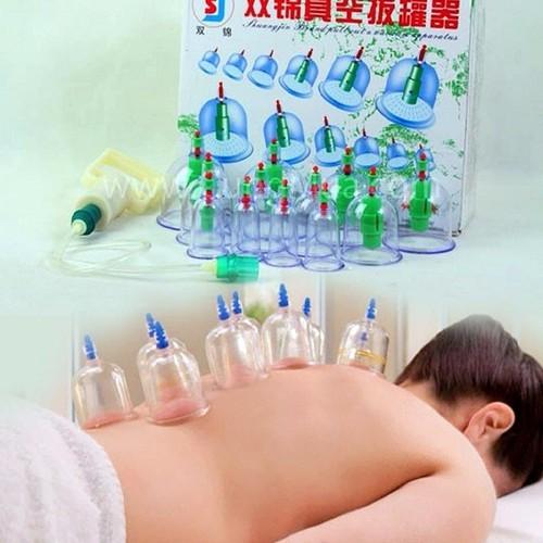 [HCM]Bộ giác hơi không dùng lửa