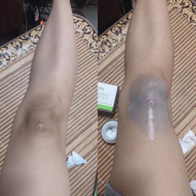 Kem Thâm Nách Ol Cell