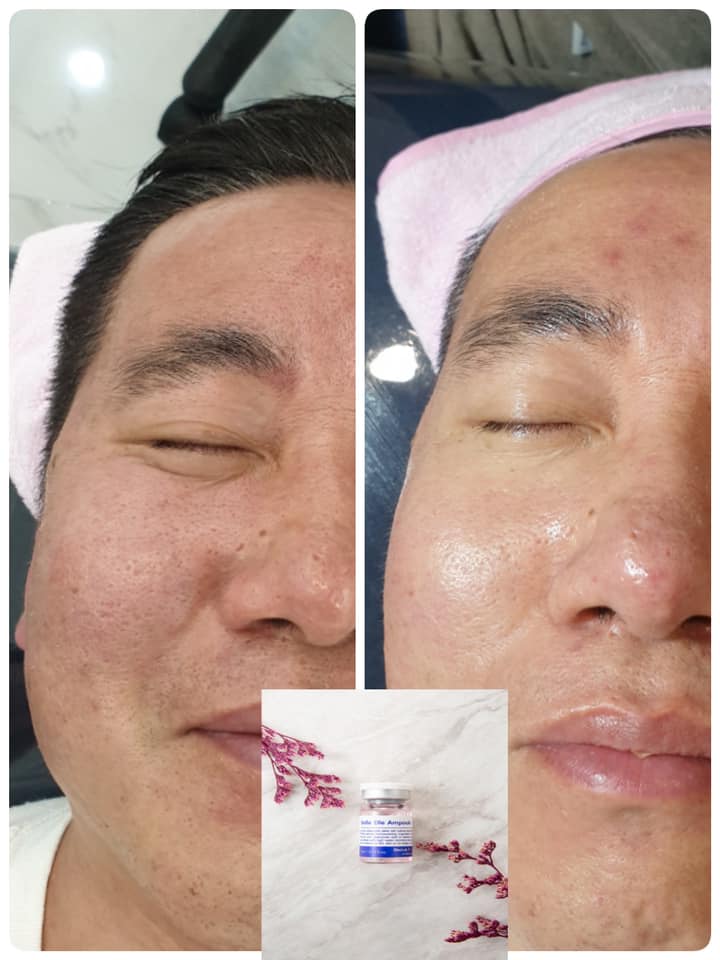 Tế bào gốc Doclab Platinum Belle Elle Ampoule