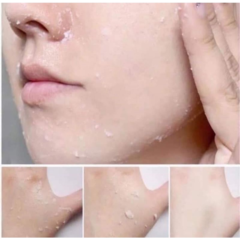 TẨY TẾ BÀO CHẾT ARRAHAN HÀN QUỐC ̣̣