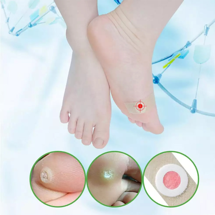 Miếng dán tẩy mụn cóc, mụn nhọt vết chai C42 (Hộp 42 miếng)