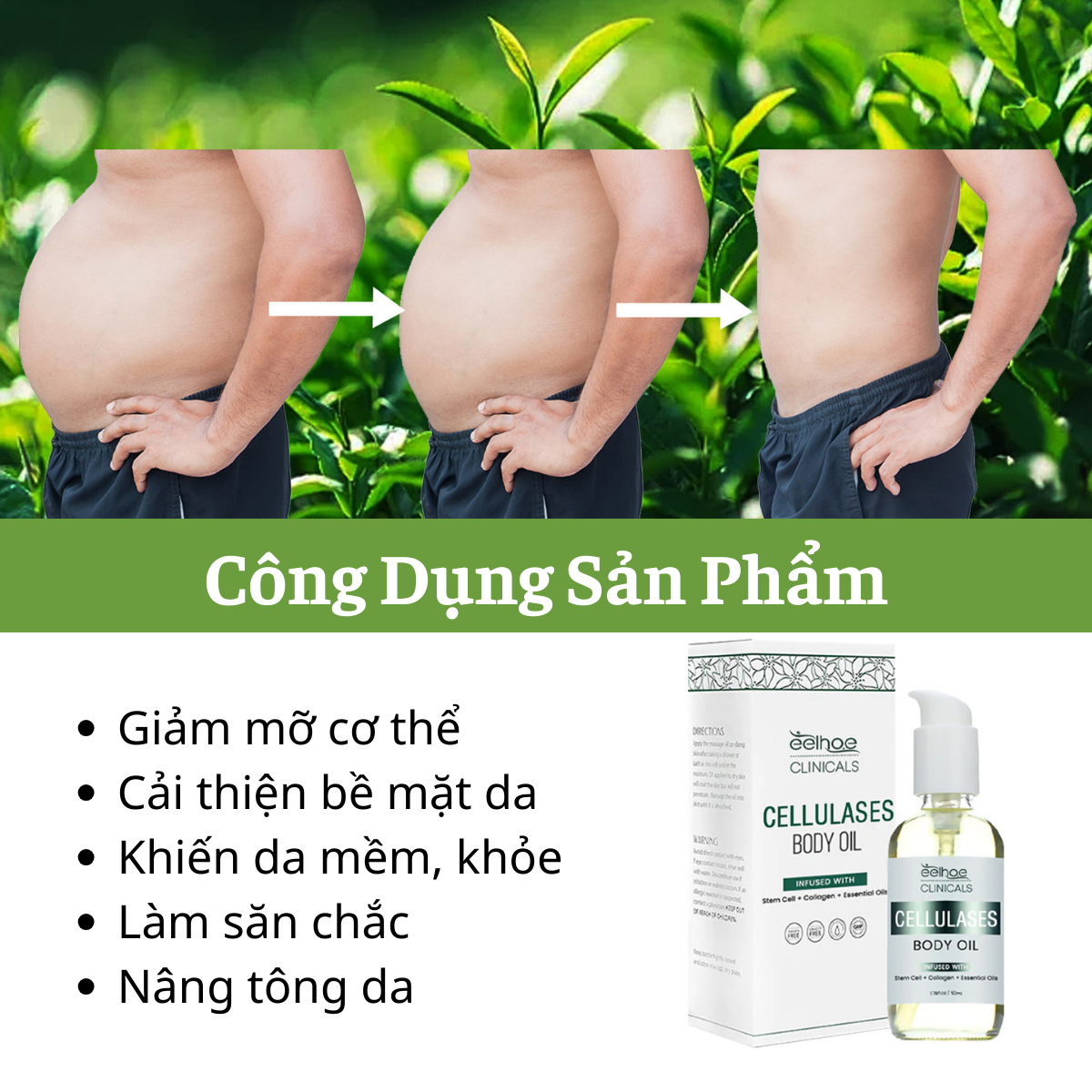 (MS34) Serum Đánh Tan Mỡ Thừa Trả Lại Vòng Eo Con Kiến Đáng Mơ Ước