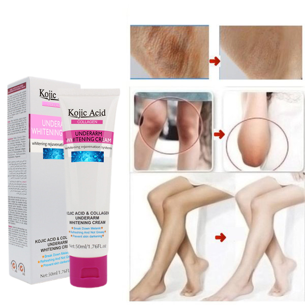 Kojic Acid Pink Whitening Body Cream, Kem làm trắng da vùng nách, chân và đầu gối，Làm cho da trắng và mịn, loại bỏ mùi hôi.
