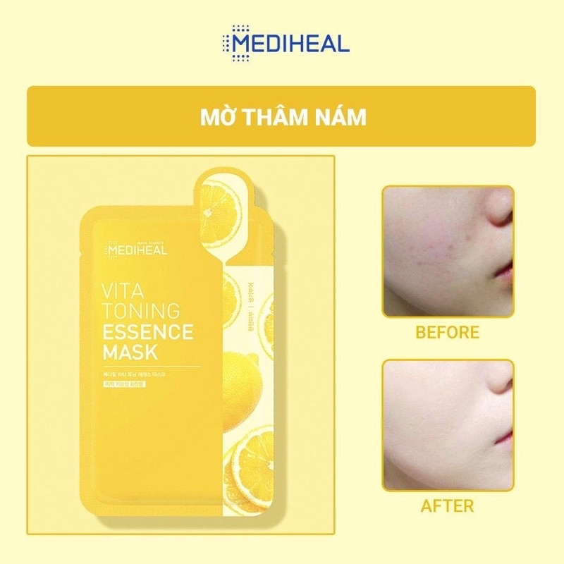 Mặt Nạ Mediheal Ampoule Mask/Solution Mask/Essential Mask Ex