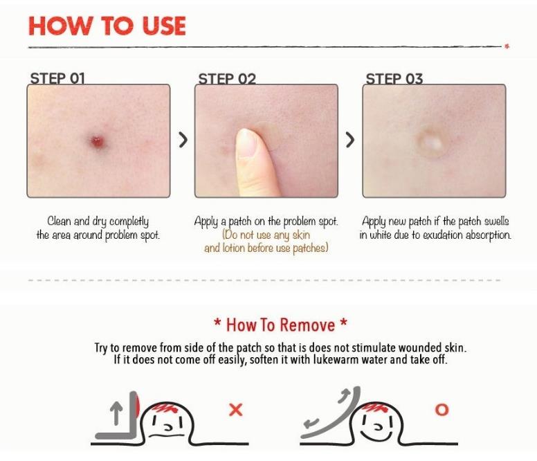 [HCM]Miếng Dán Hút Mụn COSRX Acne Pimple Master Patch 24 miếng/ gói