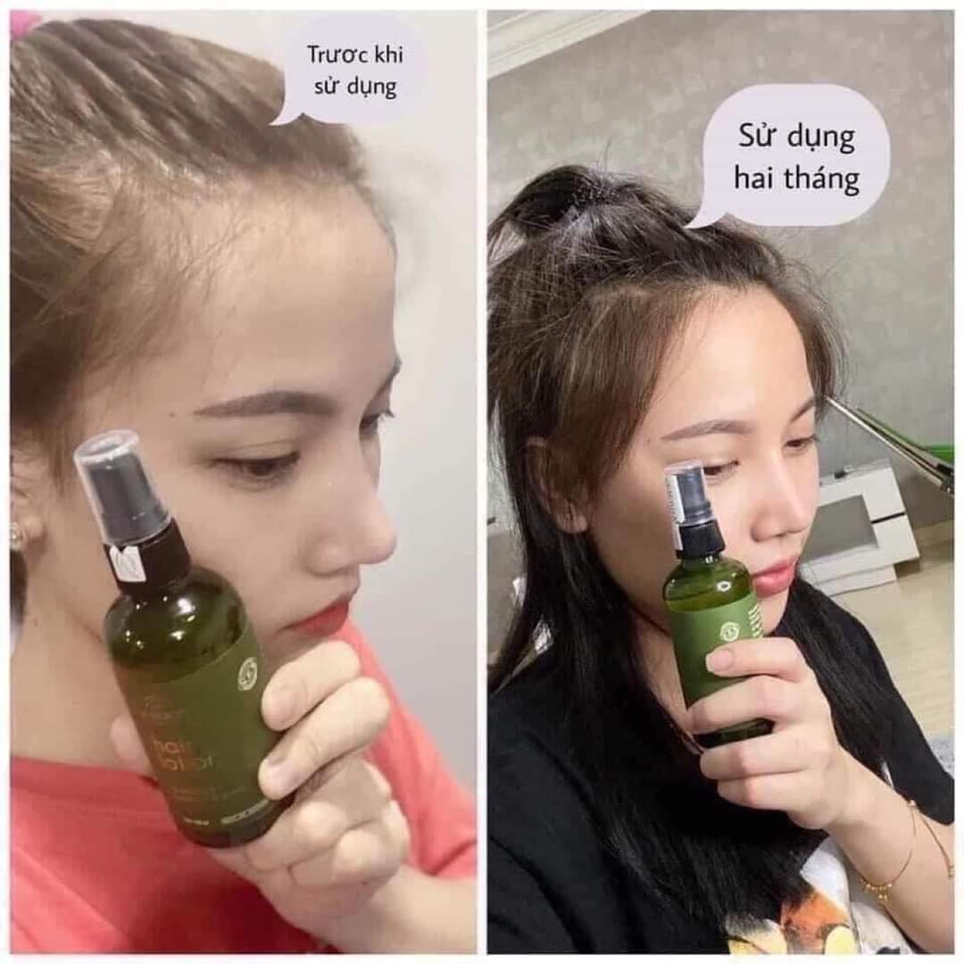 Xịt bưởi Vijully giúp kích mọc tóc và ngăn rụng tóc