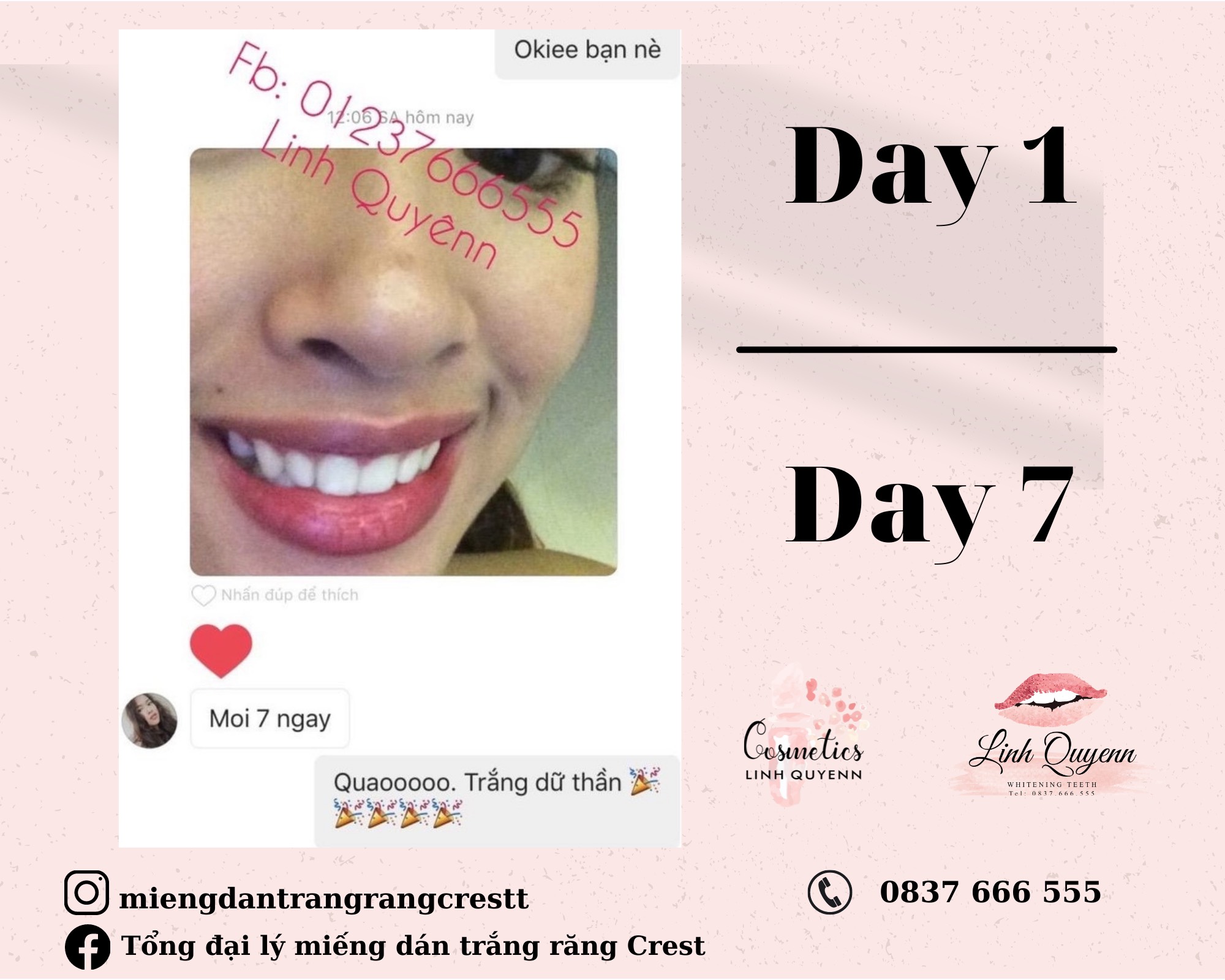 Miếng Dán Trắng Răng Crest 3D White Sensitive mẫu mới (Gentle Doux Whitestrips) - FULLBOX - CHO RĂNG NH