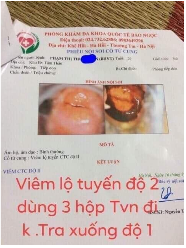 tiêu viêm nữ hoàng sơn TẶNG cốt xông rửa