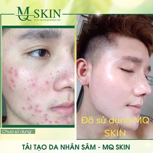 Serum Thay Da Nhân Sâm MQ MSKIN
