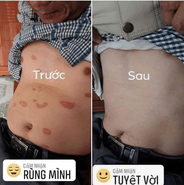 [HCM][CHÍNH HÃNG] Kem Bôi Da Thuần Mộc