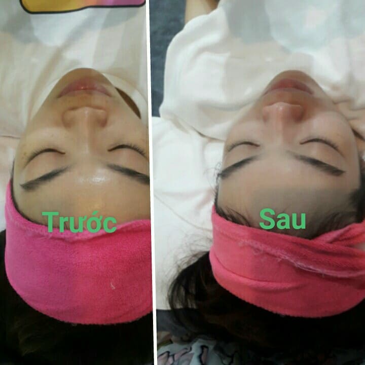 Mặt nạ ủ trắng hoa anh đào Sakura  (MUA 5 TẶNG 1)