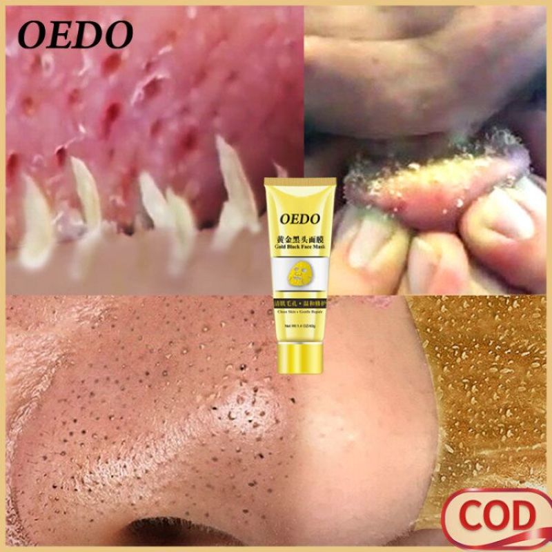 OEDO Vàng loại bỏ mụn đầu đen thu nhỏ lỗ chân lông cải thiện làn da xù xì mụn trứng cá Kem dưỡng ẩm mặt