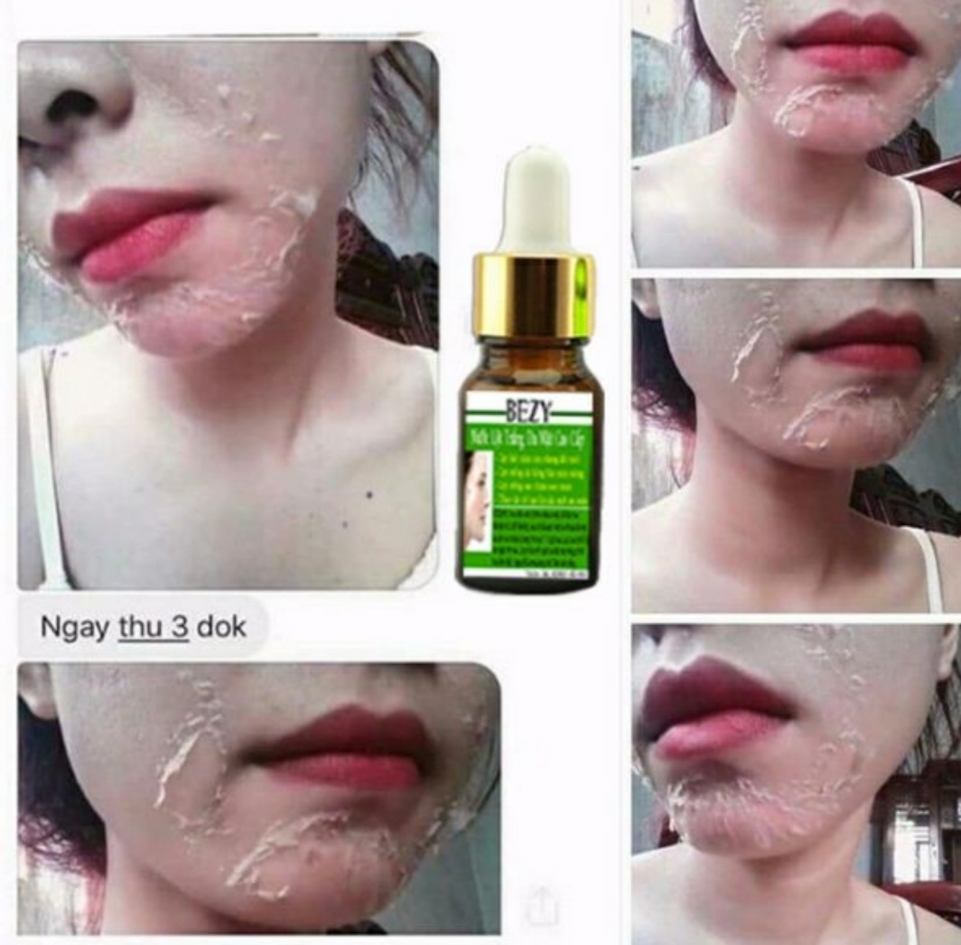 Bộ Peel Da Mặt & Kem Trắng Da Collagen