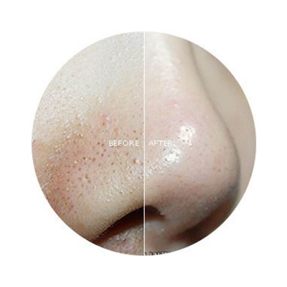 [1 MIẾNG LẺ]  Mặt Nạ Đẩy Mụn Đầu Đen Ciracle Goodbye Blackhead