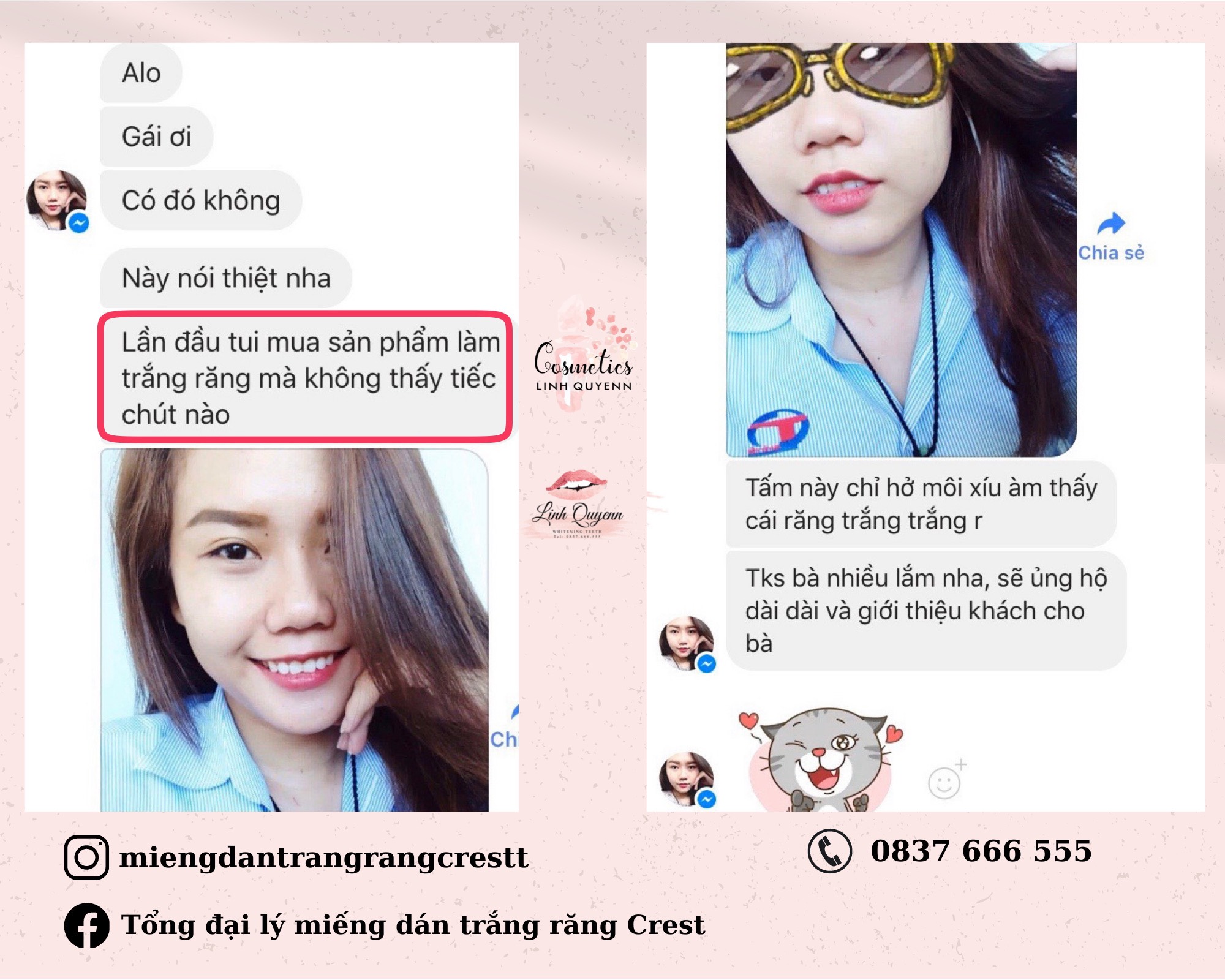 Miếng Dán Trắng Răng Crest 3D White Sensitive mẫu mới (Gentle Doux Whitestrips) - FULLBOX - CHO RĂNG NH