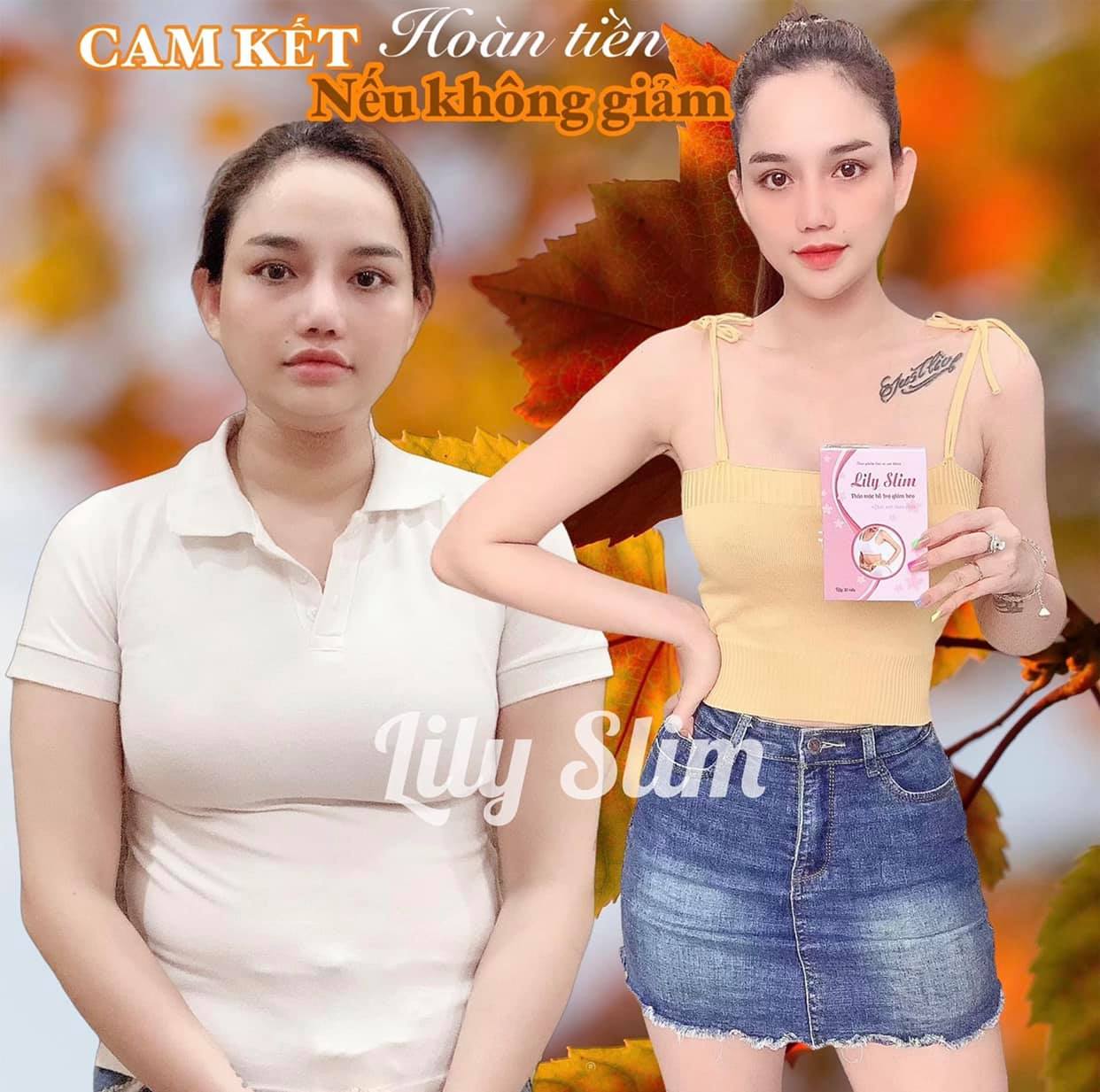 Combo 3 hộp thảo mộc giảm cân Lily Slim