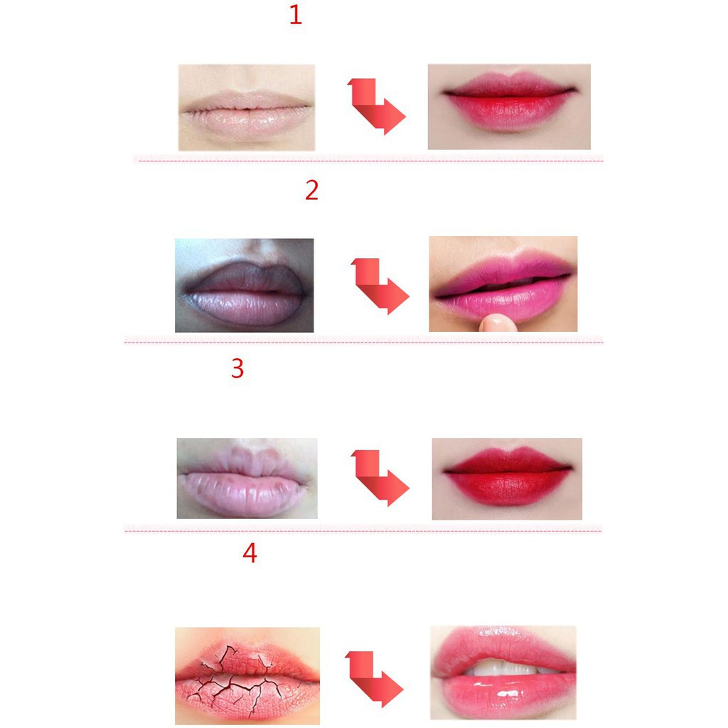 Dưỡng Kích Màu Môi Sau Xăm Pcd