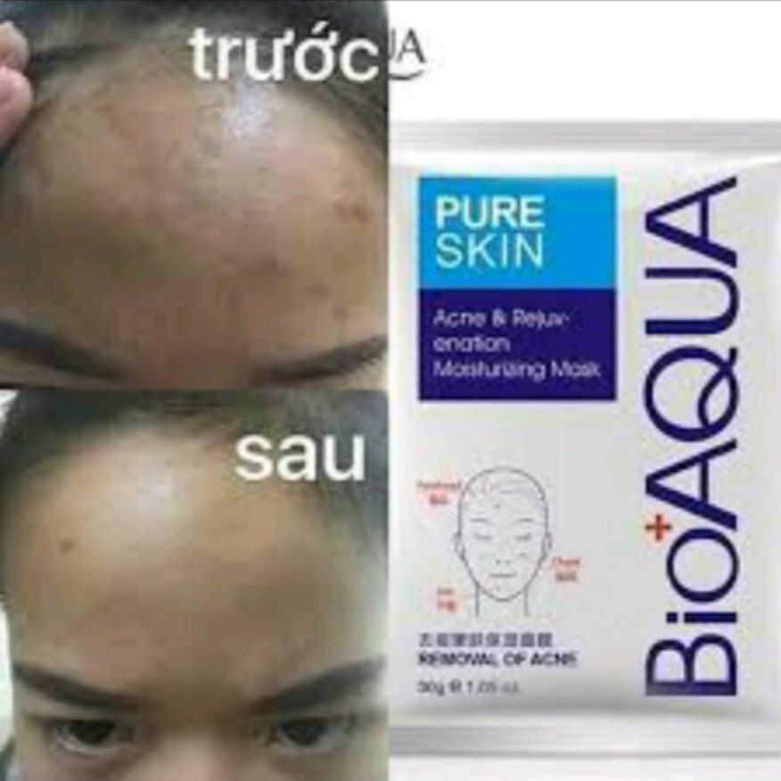 Mặt nạ giảm mụn Bioaqua pure skin
