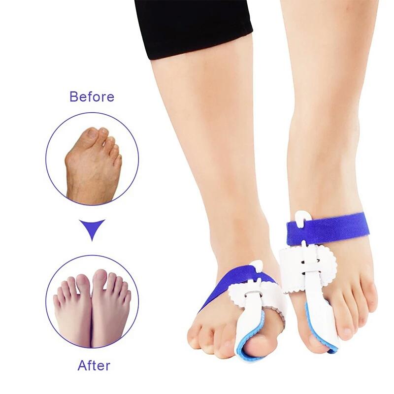DỤNG CỤ NẸP ĐỊNH HÌNH NGÓN CHÂN CÁI