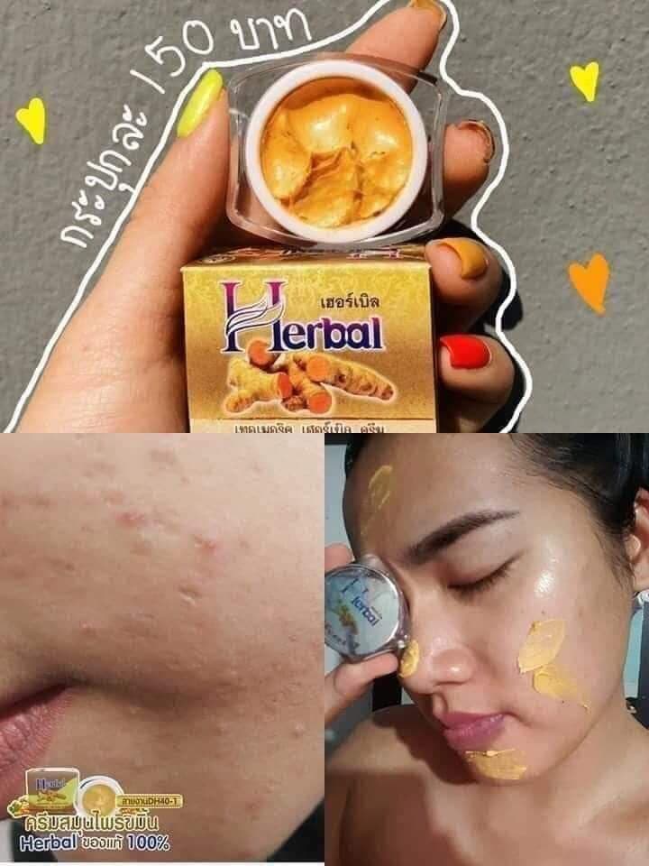 Kem nghệ Herbal Thái Lan trắng da giảm mụn chống thâm