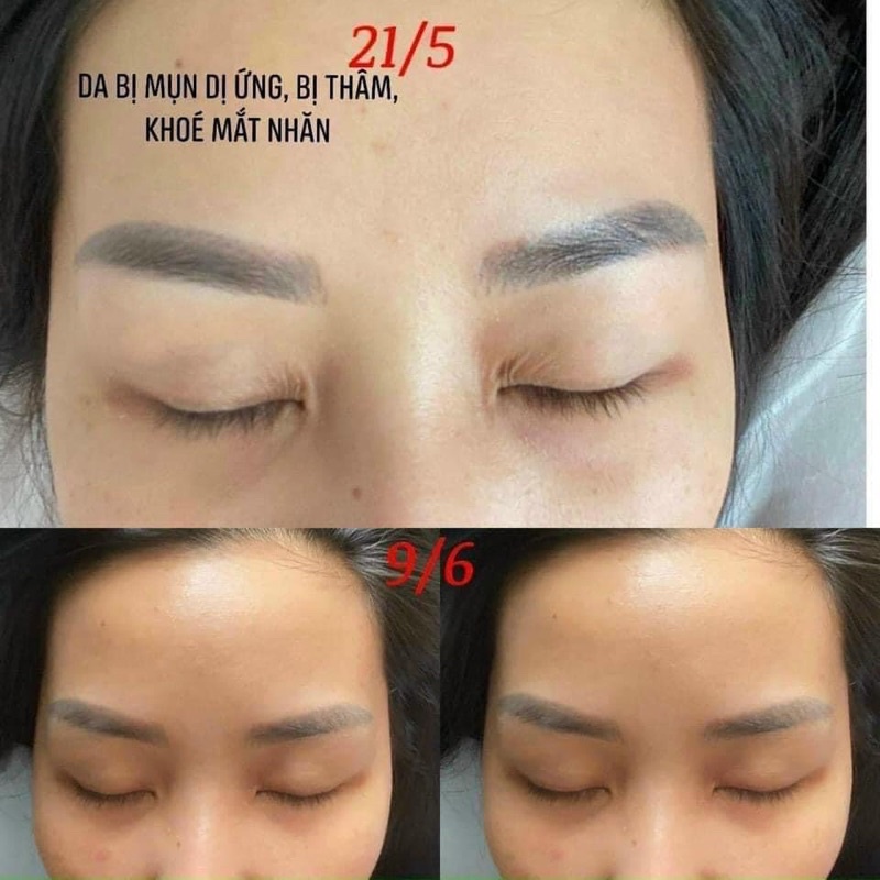 Nước uống đẹp da SKINSHOT. ( 30 lọ)
