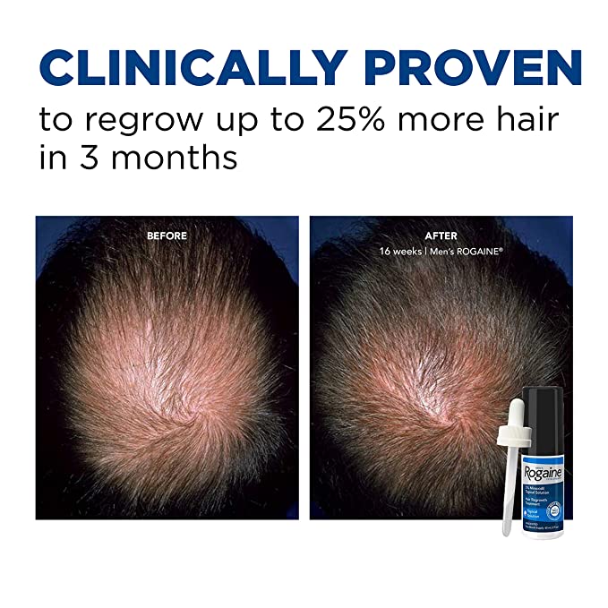 Kem mọc tóc Nam Rogaine Minoxidil 5% Extra Strength For Men 60ml