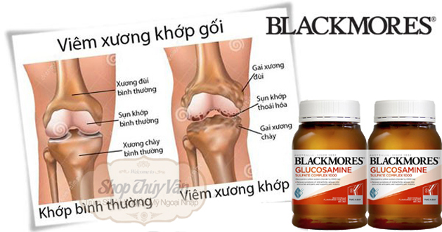 BLACKMORE GLUCOSAMIN Sulfate complex 1000 MG (Bổ khớp Hàng Úc Date xa)