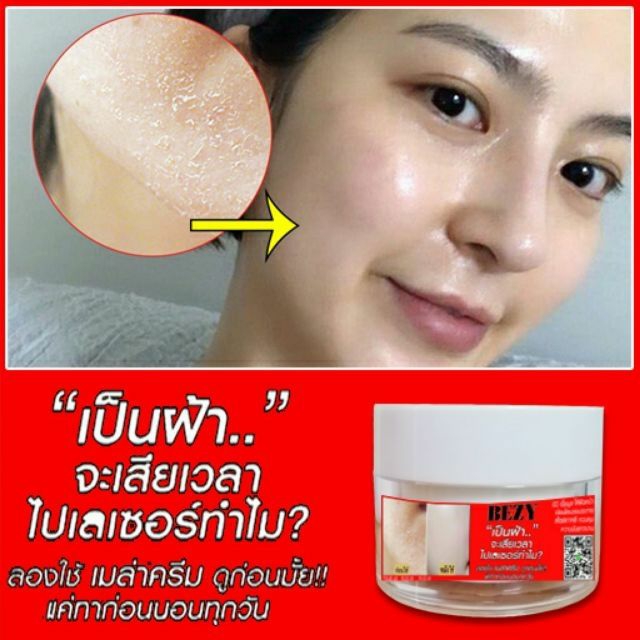 [HCM]KEM KÍCH BONG DA THAILAN